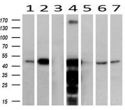 ACAA2 Antibody (OTI1C10), Novus Biologicals 0.1mL; Unlabeled:Antibodies,