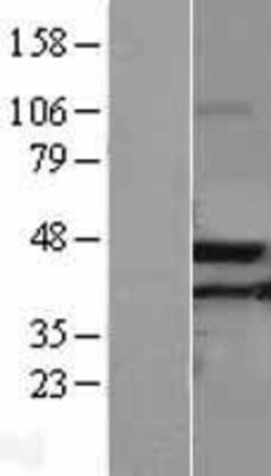 Novus Biologicals&trade;&nbsp;ACAA2 Overexpression Lysate