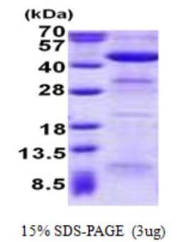 Novus Biologicals&trade;&nbsp;Recombinant Human ACAA2 His Protein