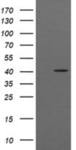 ACAA2 Antibody (OTI1C10), Novus Biologicals 0.1mL; Unlabeled:Antibodies,