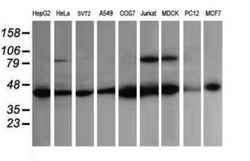 ACAA2 Antibody (OTI1C10), Novus Biologicals 0.1mL; Unlabeled:Antibodies,