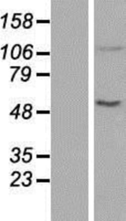Novus Biologicals™ ACAD10 Overexpression Lysate