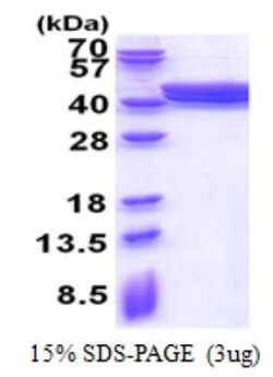 Novus Biologicals&trade;&nbsp;Recombinant Human ACAD8 His Protein
