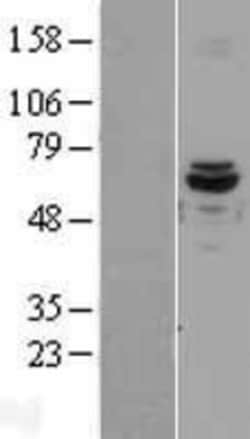 Novus Biologicals&trade;&nbsp;ACAD9 Overexpression Lysate