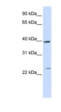 ACADL Antibody, Novus Biologicals 0.05mg; Unlabeled:Antibodies, Polyclonal