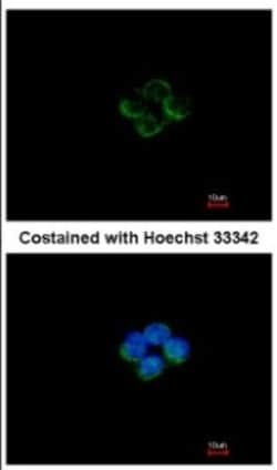 ACADM Antibody, Novus Biologicals 0.1mL; Unlabeled:Antibodies, Polyclonal