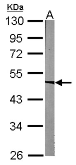 ACADM Antibody, Novus Biologicals 0.1mL; Unlabeled:Antibodies, Polyclonal