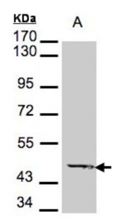 ACADM Antibody, Novus Biologicals 0.1mL; Unlabeled:Antibodies, Polyclonal