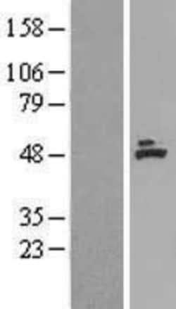 Novus Biologicals&trade;&nbsp;ACADM Overexpression Lysate