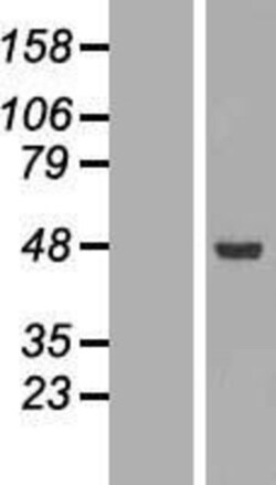 Novus Biologicals&trade;&nbsp;ACADSB Overexpression Lysate
