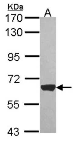 ACADVL Antibody, Novus Biologicals 0.1mL; Unlabeled:Antibodies, Polyclonal