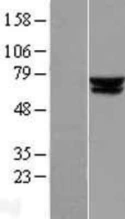 Novus Biologicals™ ACADVL Overexpression Lysate