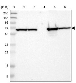 ACADVL Antibody, Novus Biologicals 0.1mL; Unlabeled:Antibodies, Polyclonal