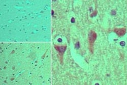ACAP4 Antibody, Novus Biologicals 0.025mg; Unlabeled:Antibodies, Polyclonal