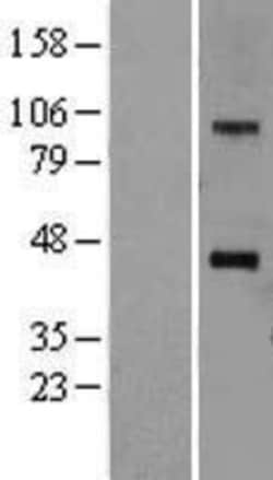Novus Biologicals&trade;&nbsp;SOAT1 Overexpression Lysate