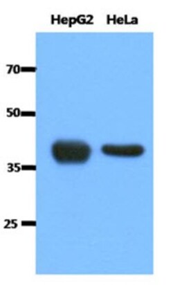 ACAT1 Antibody (2C5) - BSA Free, Novus Biologicals 0.1mL; Unlabeled:Antibodies,