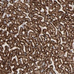 ACAT1 Antibody, Novus Biologicals:Antibodies:Primary Antibodies