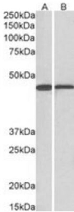 ACAT1 Antibody, Novus Biologicals 0.1mg; Unlabeled:Antibodies, Polyclonal