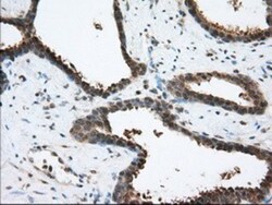 ACAT2 Antibody (OTI3E2), Novus Biologicals 0.1mL; Unlabeled:Antibodies,