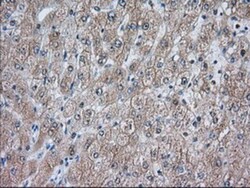 ACAT2 Antibody (OTI3E2), Novus Biologicals 0.1mL; Unlabeled:Antibodies,