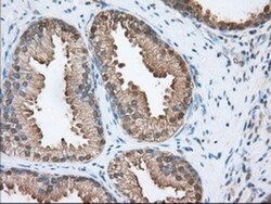 ACAT2 Antibody (OTI3E2), Novus Biologicals 0.1mL; Unlabeled:Antibodies,