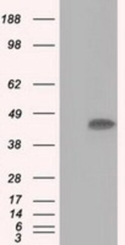 ACAT2 Antibody (OTI3E2), Novus Biologicals 0.1mL; Unlabeled:Antibodies,