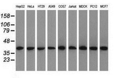 ACAT2 Antibody (OTI3E2), Novus Biologicals 0.1mL; Unlabeled:Antibodies,