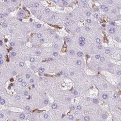 ACAT Antibody, Novus Biologicals 0.1mL; Unlabeled:Antibodies, Polyclonal