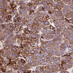 ACAT Antibody, Novus Biologicals 0.1mL; Unlabeled:Antibodies, Polyclonal