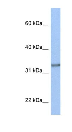 ACBD4 Antibody, Novus Biologicals 100&mu;L; Unlabeled:Antibodies, Polyclonal