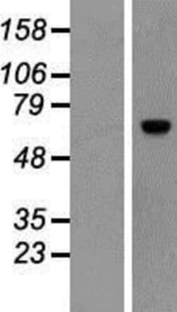 Novus Biologicals&trade;&nbsp;ACBD5 Overexpression Lysate