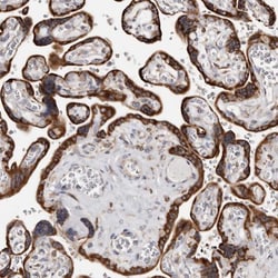 ACBD6 Antibody, Novus Biologicals:Antibodies:Primary Antibodies