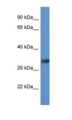 ACBD6 Antibody, Novus Biologicals 100 &mu;L | Buy Online | Novus Biologicals | Fisher Scientific