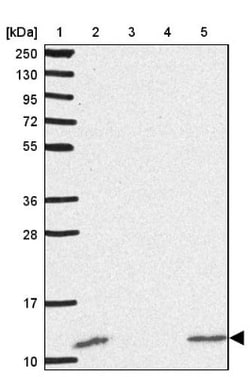 ACBP Antibody, Novus Biologicals 0.1mL; Unlabeled:Antibodies, Polyclonal