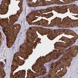 ACBP Antibody, Novus Biologicals 0.1mL; Unlabeled:Antibodies, Polyclonal