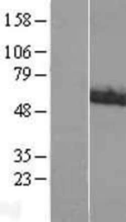 Novus Biologicals™ ACCN1 Overexpression Lysate
