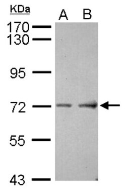 ACCN4 Antibody, Novus Biologicals 0.1mL; Unlabeled:Antibodies, Polyclonal