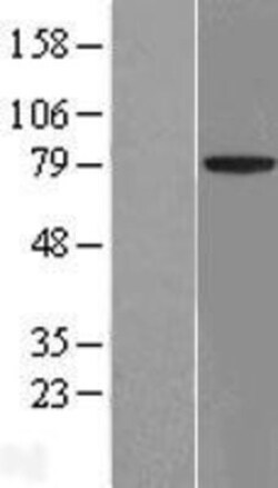 Novus Biologicals™ ACCN4 Overexpression Lysate