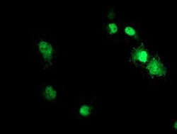 ACD Antibody (OTI1A2), Novus Biologicals 0.1mL; Unlabeled:Antibodies, Monoclonal