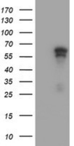 ACD Antibody (OTI1A2), Novus Biologicals 0.1mL; Unlabeled:Antibodies, Monoclonal