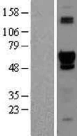 Novus Biologicals&trade;&nbsp;ACD Overexpression Lysate