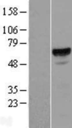 Novus Biologicals™ ACD Overexpression Lysate