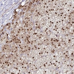 ACD Antibody, Novus Biologicals:Antibodies:Primary Antibodies