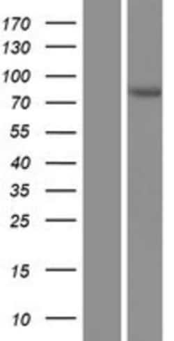 Novus Biologicals&trade;&nbsp;Acetoacetyl CoA synthetase Overexpression Lysate
