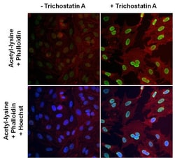Acetyl-Lysine Antibody (1C6), Novus Biologicals 100 ug; Unconjugated:Antibodies,