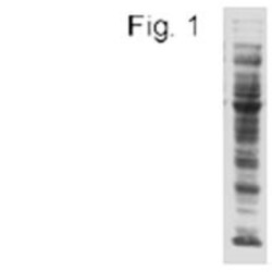 Acetyl-Lysine Antibody (1C6), Novus Biologicals 100 ug; Unconjugated:Antibodies,