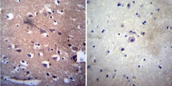 Acetylcholinesterase/ACHE Antibody (HR2) - BSA Free, Novus Biologicals