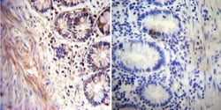 Acetylcholinesterase/ACHE Antibody (HR2) - BSA Free, Novus Biologicals