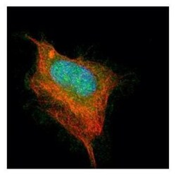 Acetylcholinesterase/ACHE Antibody, Novus Biologicals 0.1mg; Unlabeled:Antibodies,