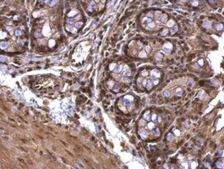 Acetylcholinesterase/ACHE Antibody, Novus Biologicals 0.1mg; Unlabeled:Antibodies,